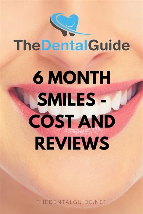 Six Month Smiles: Cost, Safety, How It Works, and 